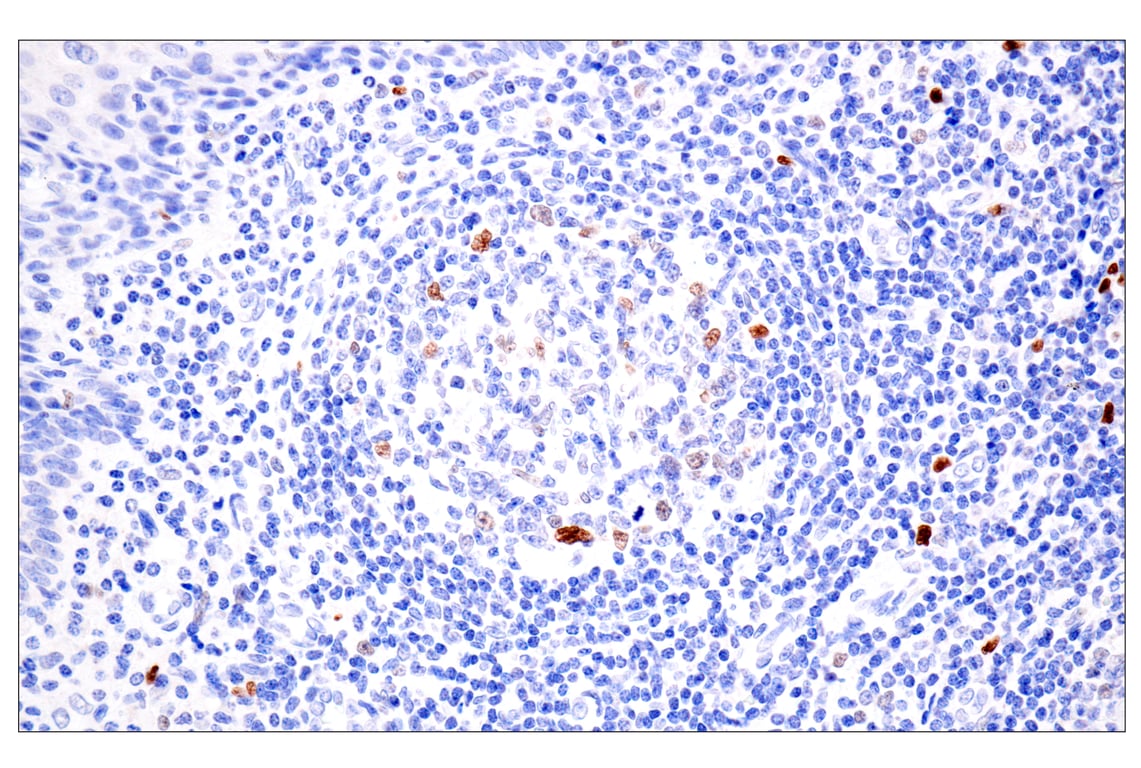 Immunohistochemistry Image 6: BATF3 (E3F3L) Rabbit mAb