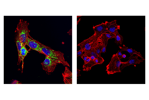 undefined Image 56: Extracellular Matrix Dynamics Antibody Sampler Kit