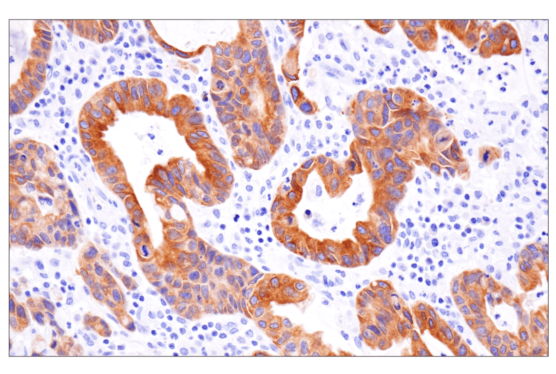 Immunohistochemistry Image 1: KK-LC-1 (F3U6C) Rabbit mAb