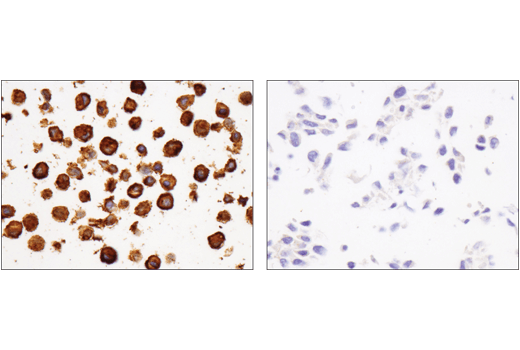 Immunohistochemistry Image 6: FcγRIIB (D8F9C) XP<sup>®</sup> Rabbit mAb