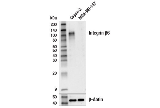 Western Blotting Image 1: Integrin β6 (E4M9P) XP® Rabbit mAb