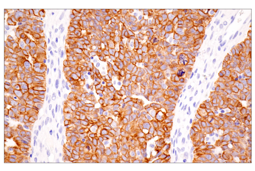 Immunohistochemistry Image 3: Pan-Keratin (5D3/LP34) Mouse mAb