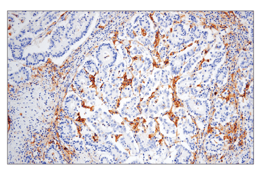 Immunohistochemistry Image 1: CD86 (E2G8P) Rabbit mAb