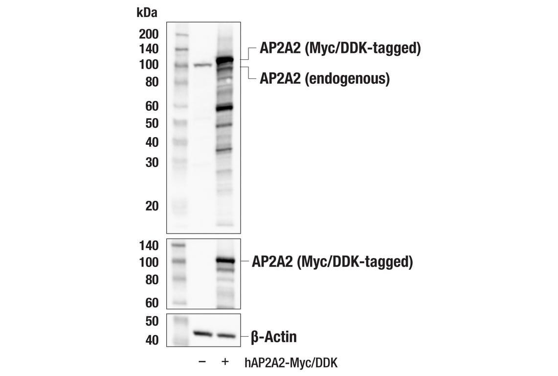 Western Blotting Image 2: AP2A2 (E9Q1O) Rabbit mAb