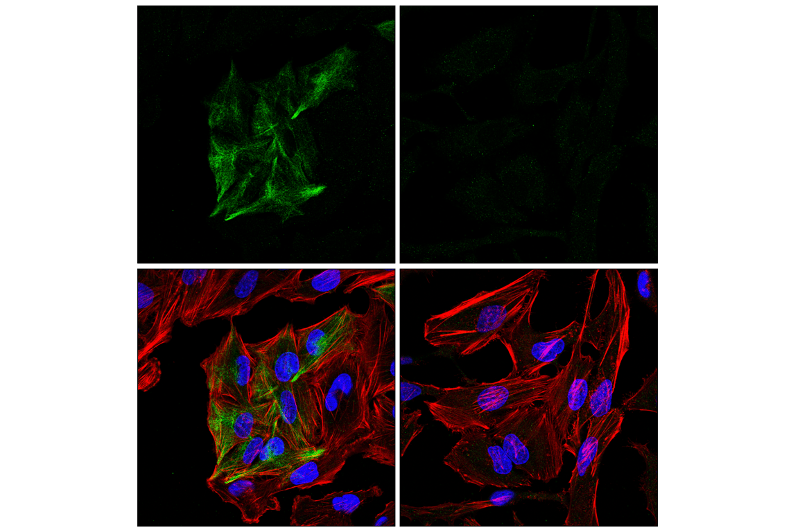 Immunofluorescence Image 1: GFAP (E8S7G) Mouse mAb