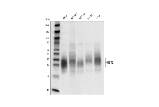 Western Blotting Image 1: BST2 (D5V5Z) Rabbit mAb