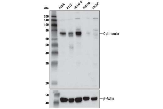 undefined Image 5: Mitophagy Antibody Sampler Kit