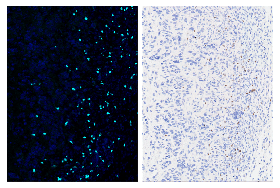 Immunohistochemistry Image 6: FoxP3 (D6O8R) & CO-0041-488 SignalStar<sup>™</sup> Oligo-Antibody Pair