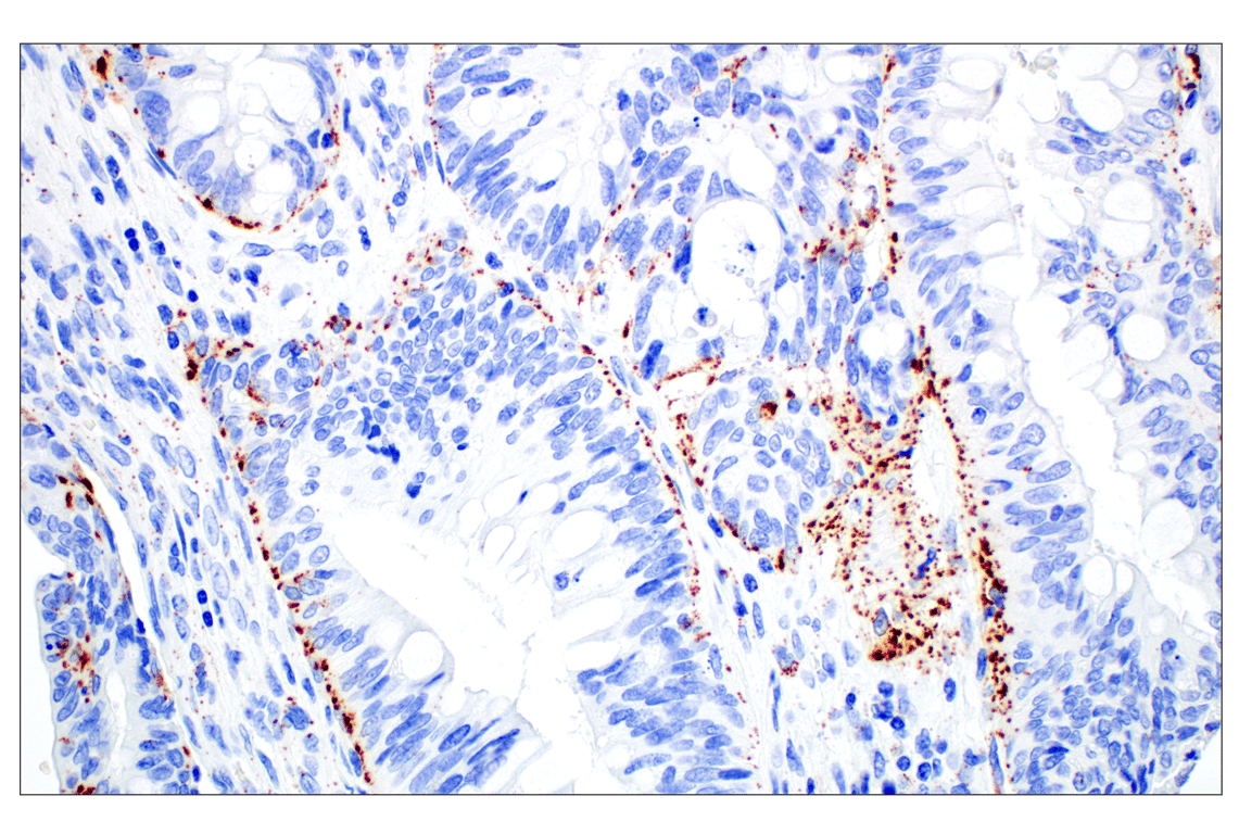 Immunohistochemistry Image 5: Perilipin-2 (E6G6M) Rabbit mAb