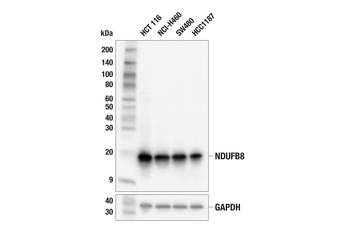 Western Blotting Image 1: NDUFB8 (E7U3O) Rabbit mAb