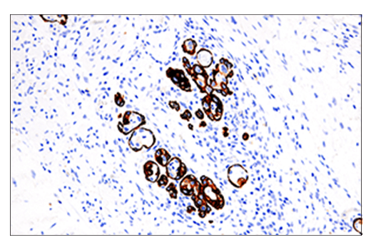 Immunohistochemistry Image 2: Keratin 5 (E2T4B) XP<sup>®</sup> Rabbit mAb