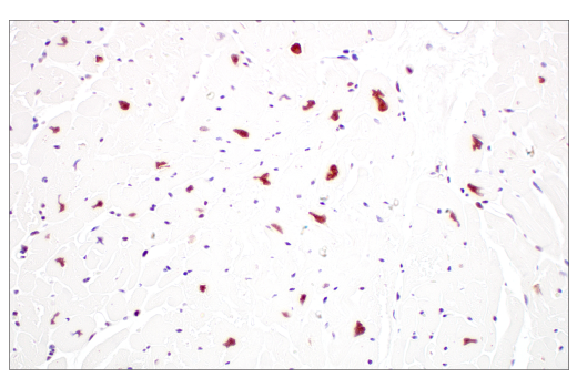 Immunohistochemistry Image 7: METTL3 (E3F2A) Rabbit mAb (BSA and Azide Free)