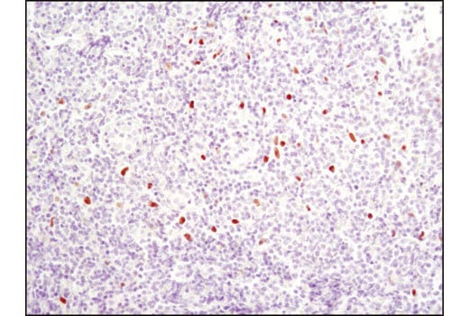 undefined Image 15: C/EBP Antibody Sampler Kit