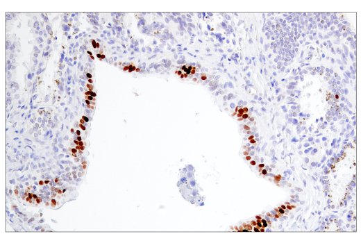 Immunohistochemistry Image 2: BCL6 (E5I8I) Rabbit mAb (BSA and Azide Free)