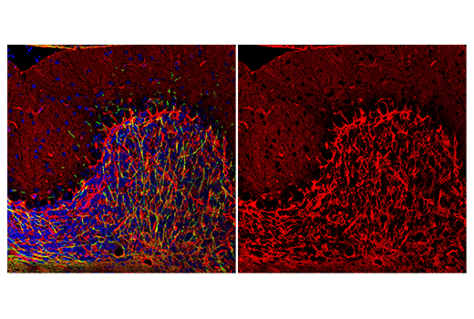 Immunofluorescence Image 1: AQP4 (D1F8E) XP<sup>®</sup> Rabbit mAb (Alexa Fluor<sup>®</sup> 647 Conjugate)