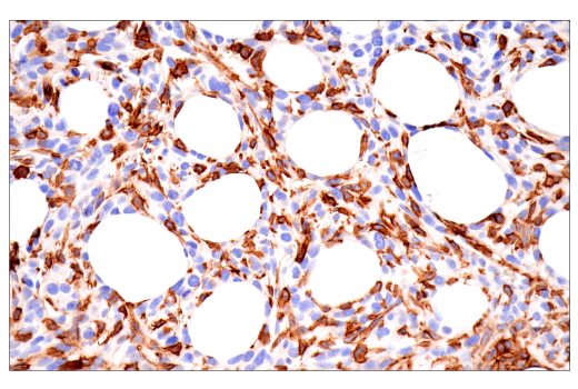 Immunohistochemistry Image 1: CD38 (E9F5A) XP<sup>®</sup> Rabbit mAb