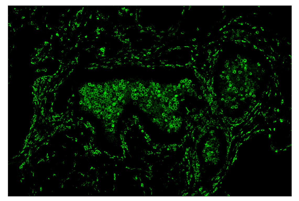 Immunohistochemistry Image 2: CD14 (D7A2T) & CO-0085-750 SignalStar<sup>™</sup> Oligo-Antibody Pair