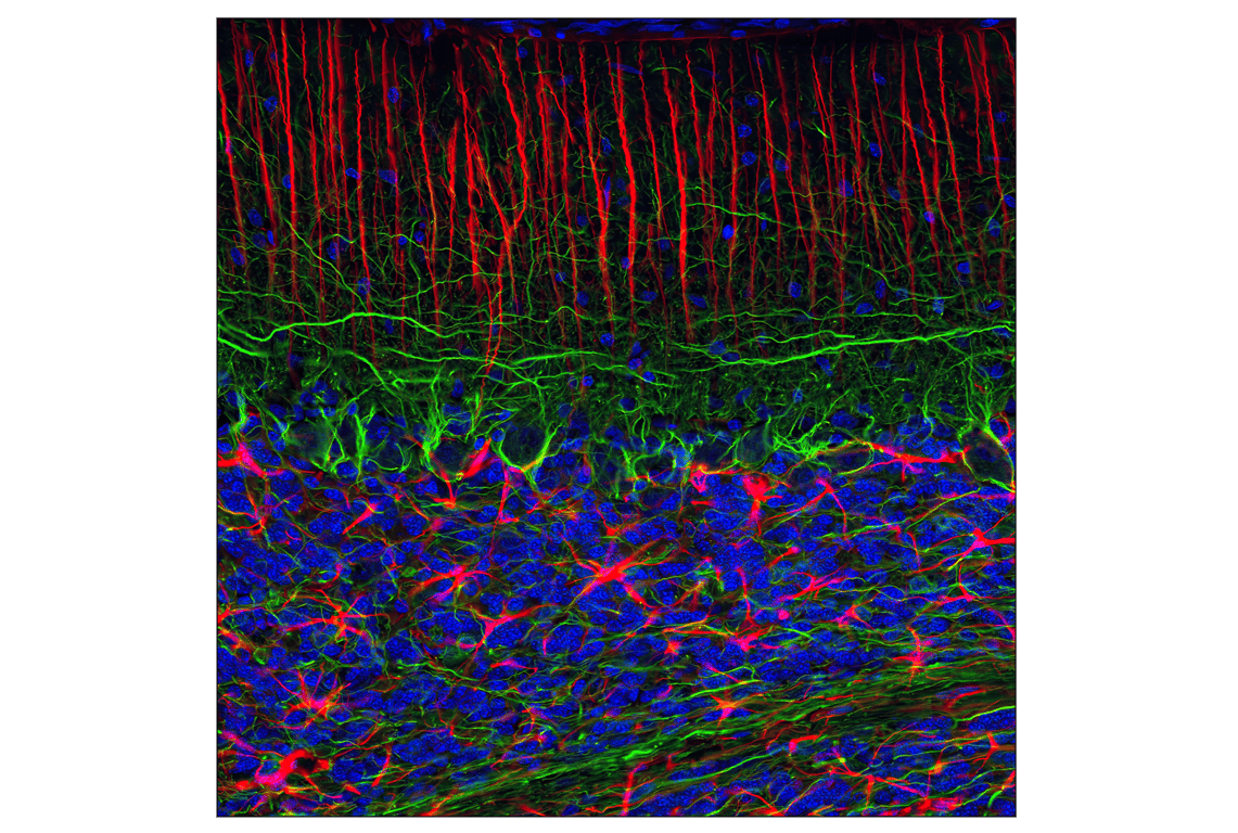 Immunofluorescence Image 1: GFAP (GA5) Mouse mAb (Alexa Fluor® 555 Conjugate)