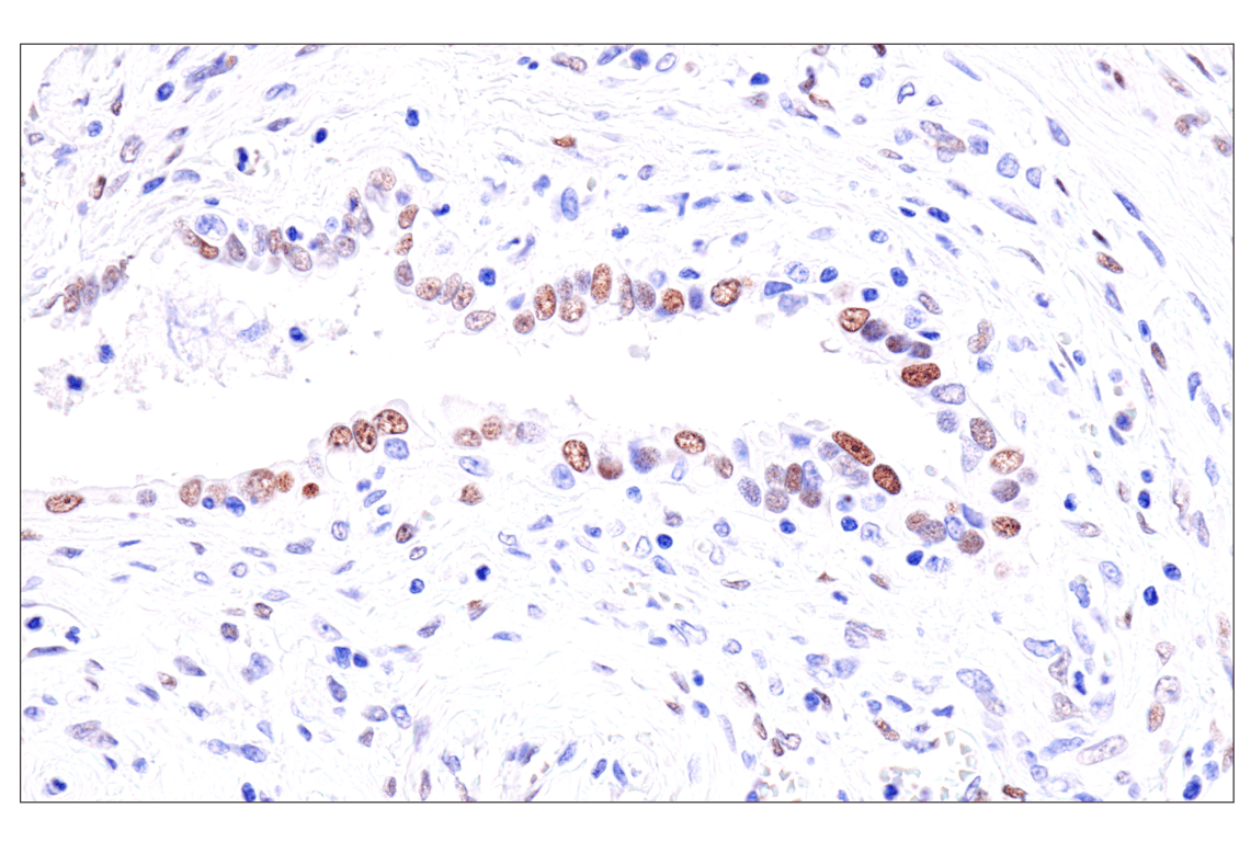 Immunohistochemistry Image 4: GATA-6 (D61E4) XP<sup>®</sup> Rabbit mAb (BSA and Azide Free)