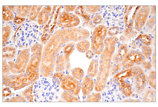 Immunohistochemistry Image 2: Cathepsin D (E7Z4L) XP<sup>®</sup> Rabbit mAb