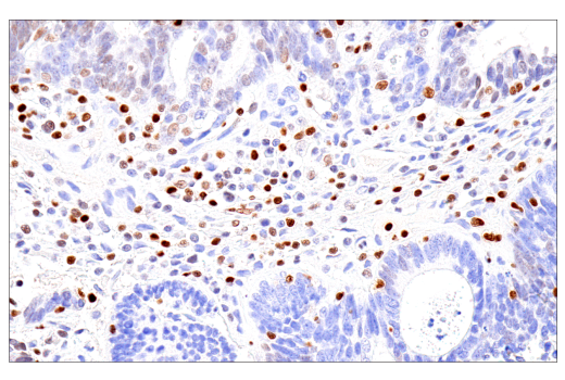 Immunohistochemistry Image 4: RUNX3/AML2 (E8D5W) XP<sup>®</sup> Rabbit mAb