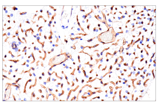 Immunohistochemistry Image 10: CD38 (E9F5A) XP<sup>®</sup> Rabbit mAb