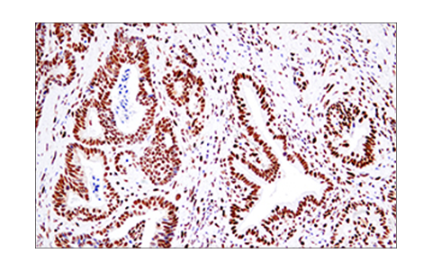 Immunohistochemistry Image 5: 53BP1 (E7N5D) XP<sup>®</sup> Rabbit mAb (BSA and Azide Free)