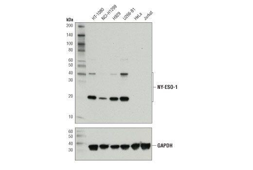 Western Blotting Image 1: NY-ESO-1 (D1Q2U) Rabbit mAb