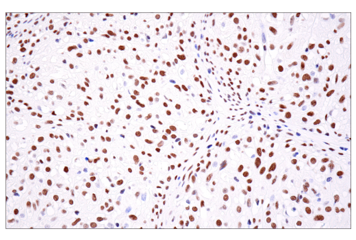 Immunohistochemistry Image 9: ATRX (E5X7O) Rabbit mAb (BSA and Azide Free)