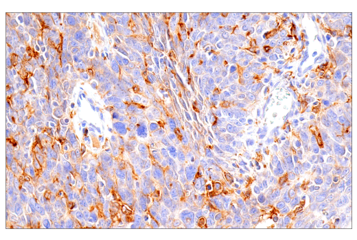 Immunohistochemistry Image 3: GM-CSF Receptor α (E8Z3S) Rabbit mAb