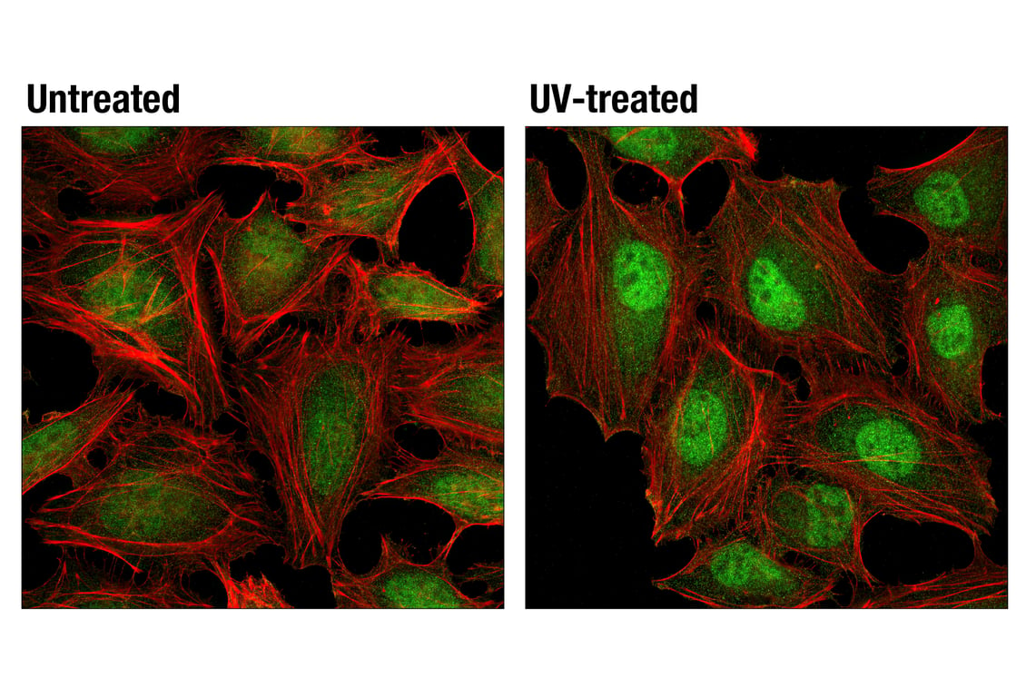 undefined Image 10: PhosphoPlus<sup>®</sup> p38 MAPK (Thr180/Tyr182) Antibody Duet