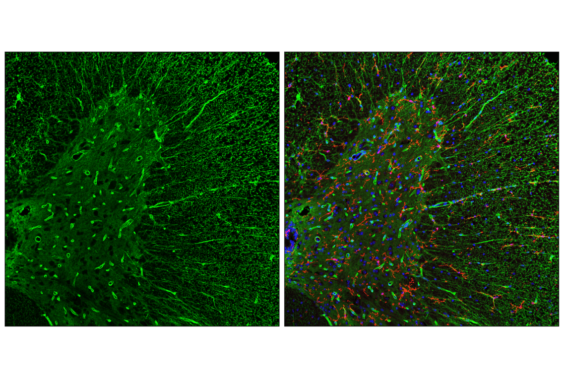 Immunofluorescence Image 2: AQP4 (E4B6T) Mouse mAb