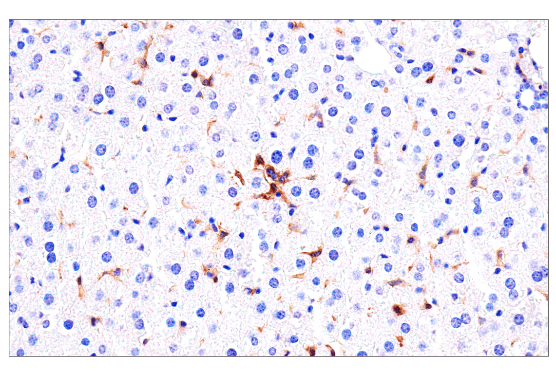 Immunohistochemistry Image 4: Axl (E3Z2H) Rabbit mAb (BSA and Azide Free)