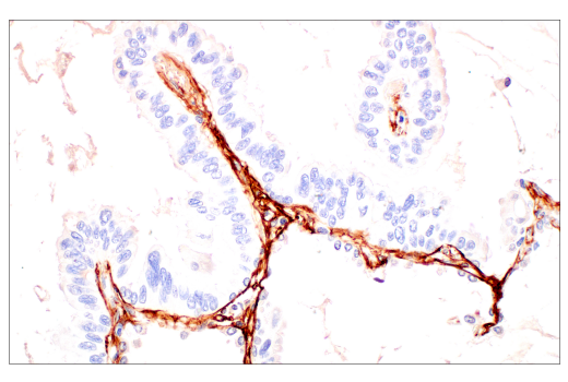 undefined Image 25: Extracellular Matrix Dynamics Antibody Sampler Kit