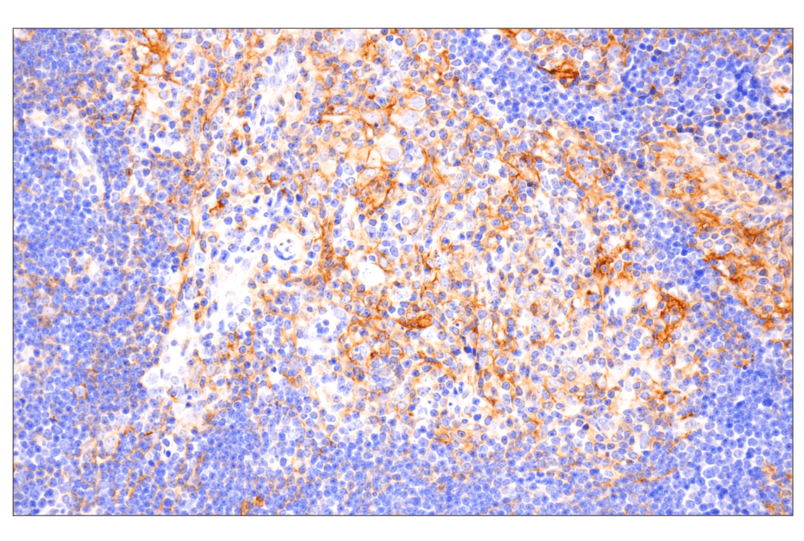 Immunohistochemistry Image 2: PD-L1 (F3Z1T) Rabbit mAb (IHC Formulated)