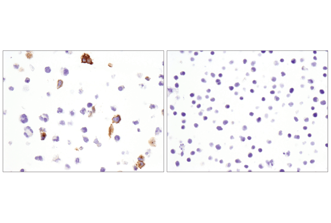 Immunohistochemistry Image 5: OX40 (E9U7O) XP<sup>®</sup> Rabbit mAb (BSA and Azide Free)