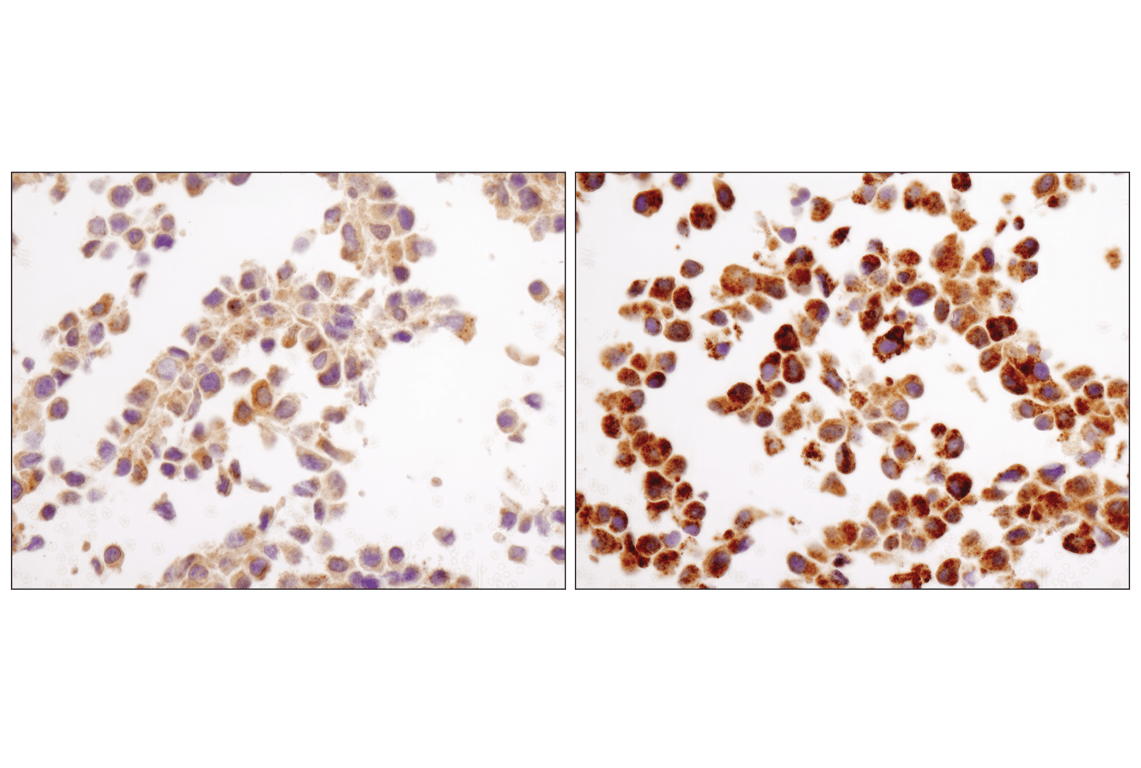 Immunohistochemistry Image 2: LC3A/B (D3U4C) XP<sup>®</sup> Rabbit mAb (BSA and Azide Free)