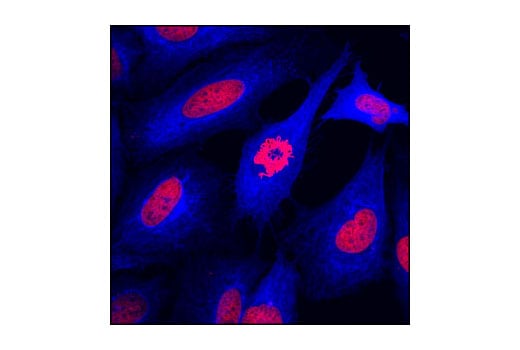 Immunofluorescence Image 1: Anti-mouse IgG (H+L), F(ab')<sub>2</sub> Fragment (Alexa Fluor<sup>®</sup> 647 Conjugate)