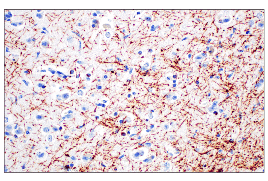 undefined Image 22: Demyelinating Disease Targets Antibody Sampler Kit