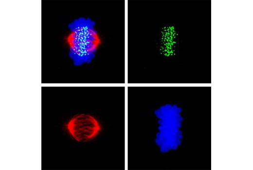 undefined Image 8: Aurora A/B Substrate Antibody Sampler Kit
