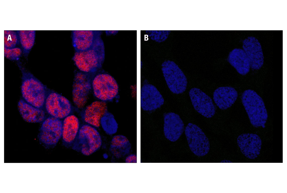 undefined Image 78: Cannabinoid Receptor 1 Downstream Signaling Antibody Sampler Kit