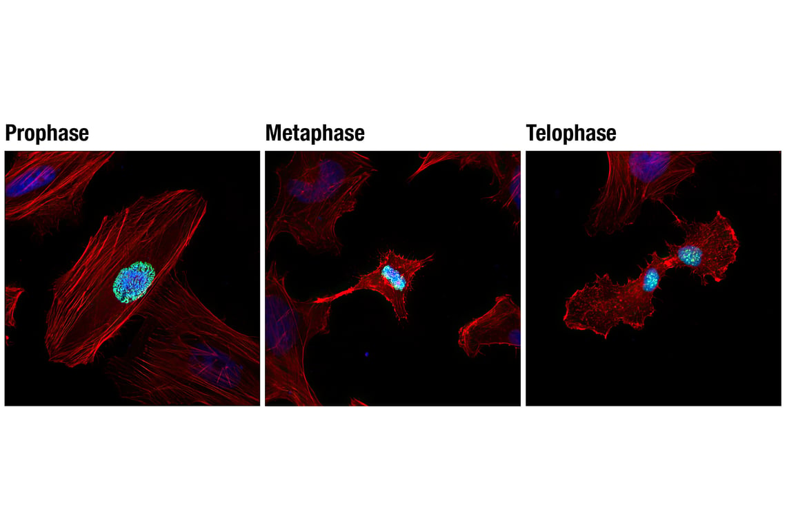 Immunofluorescence Image 1: Phospho-Histone H3 (Ser10) (D7N8E) XP<sup>®</sup> Rabbit mAb (BSA and Azide Free)