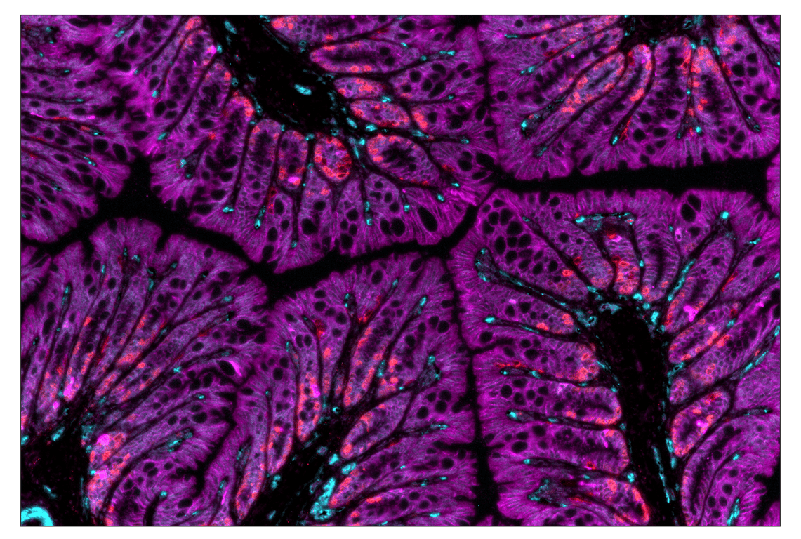 Immunohistochemistry Image 7: HER2/ErbB2 (D8F12) & CO-0059-488 SignalStar<sup>™</sup> Oligo-Antibody Pair