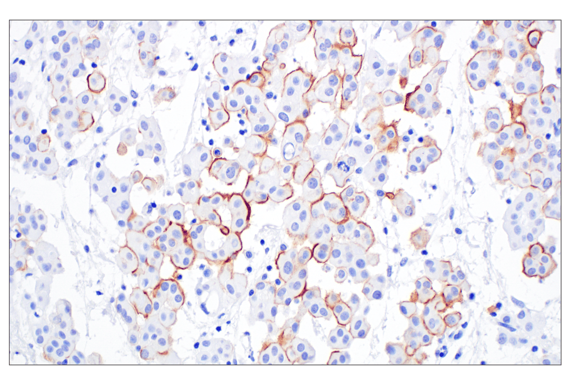 Immunohistochemistry Image 2: UPK3B (DBRRM3.66) Rabbit mAb