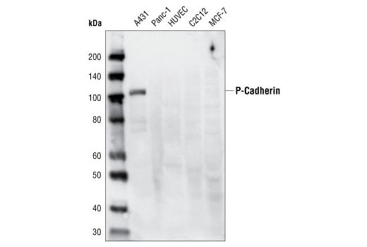 Western Blotting Image 1: P-Cadherin (C13F9) Rabbit mAb