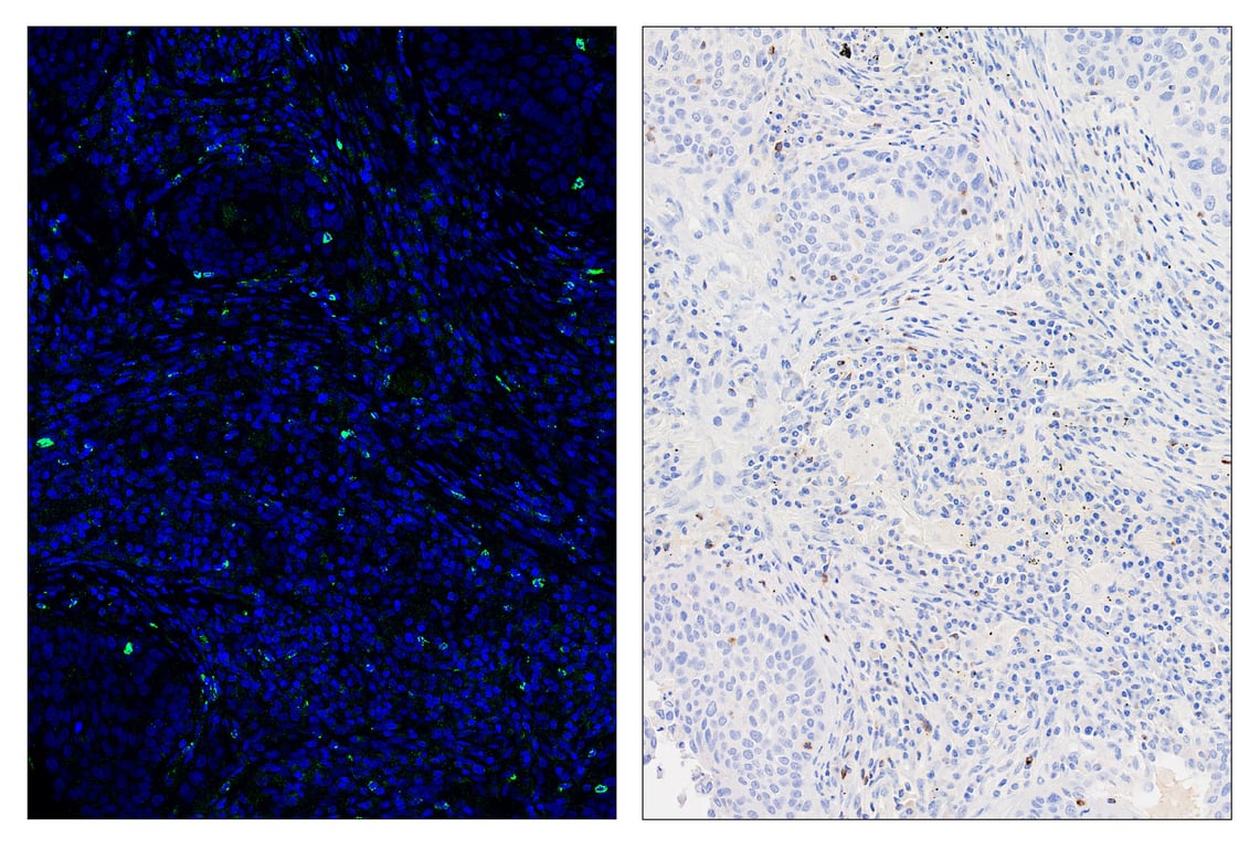 Immunohistochemistry Image 6: LAG3 (D2G4O<sup>™</sup>) & CO-0026-594 SignalStar<sup>™</sup> Oligo-Antibody Pair