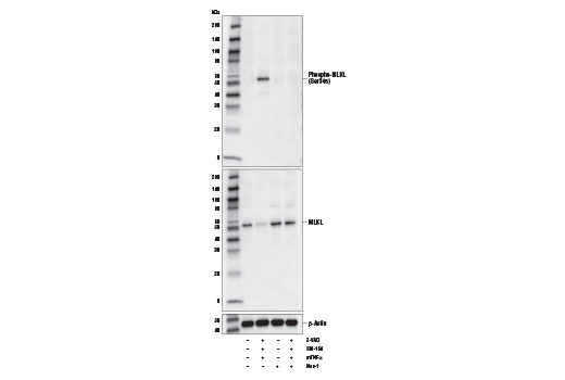 Western Blotting Image 1: Phospho-MLKL (Ser345) (D6E3G) Rabbit mAb (BSA and Azide Free)