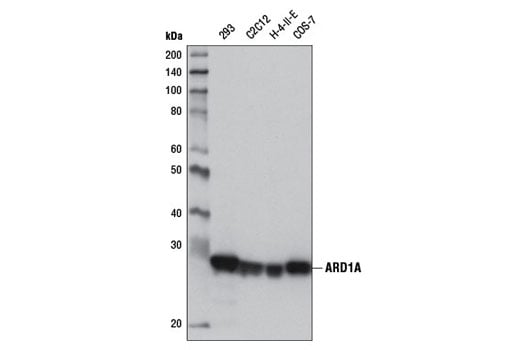 Western Blotting Image 1: ARD1A (E1J2B) Rabbit mAb