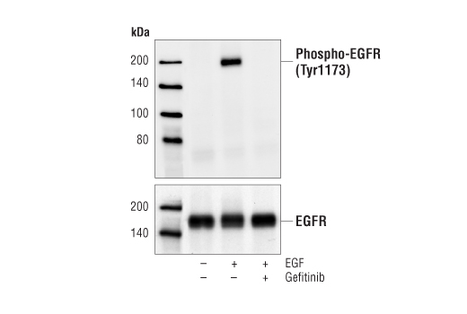 Gefitinib: Image 1