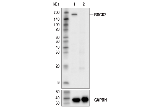 Western Blotting Image 2: ROCK2 (D1B1) Rabbit mAb